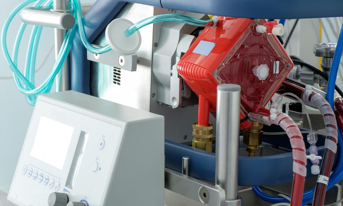 国内体外膜肺氧合（ECMO）产品获准上市